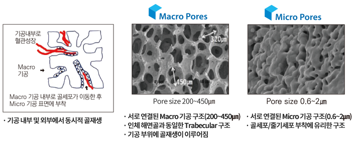 콜라세라 : Macro/Micro Pore structure